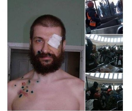 Історія пораненого 18 лютого на станції метро "Хрещатик" Антона Ковальова.