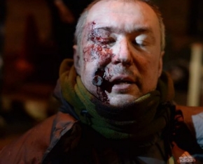 Свідчення Євгена Аврамчука, пораненого вночі 18-19 лютого