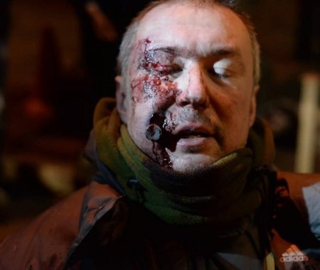 Свідчення Євгена Аврамчука, пораненого вночі 18-19 лютого